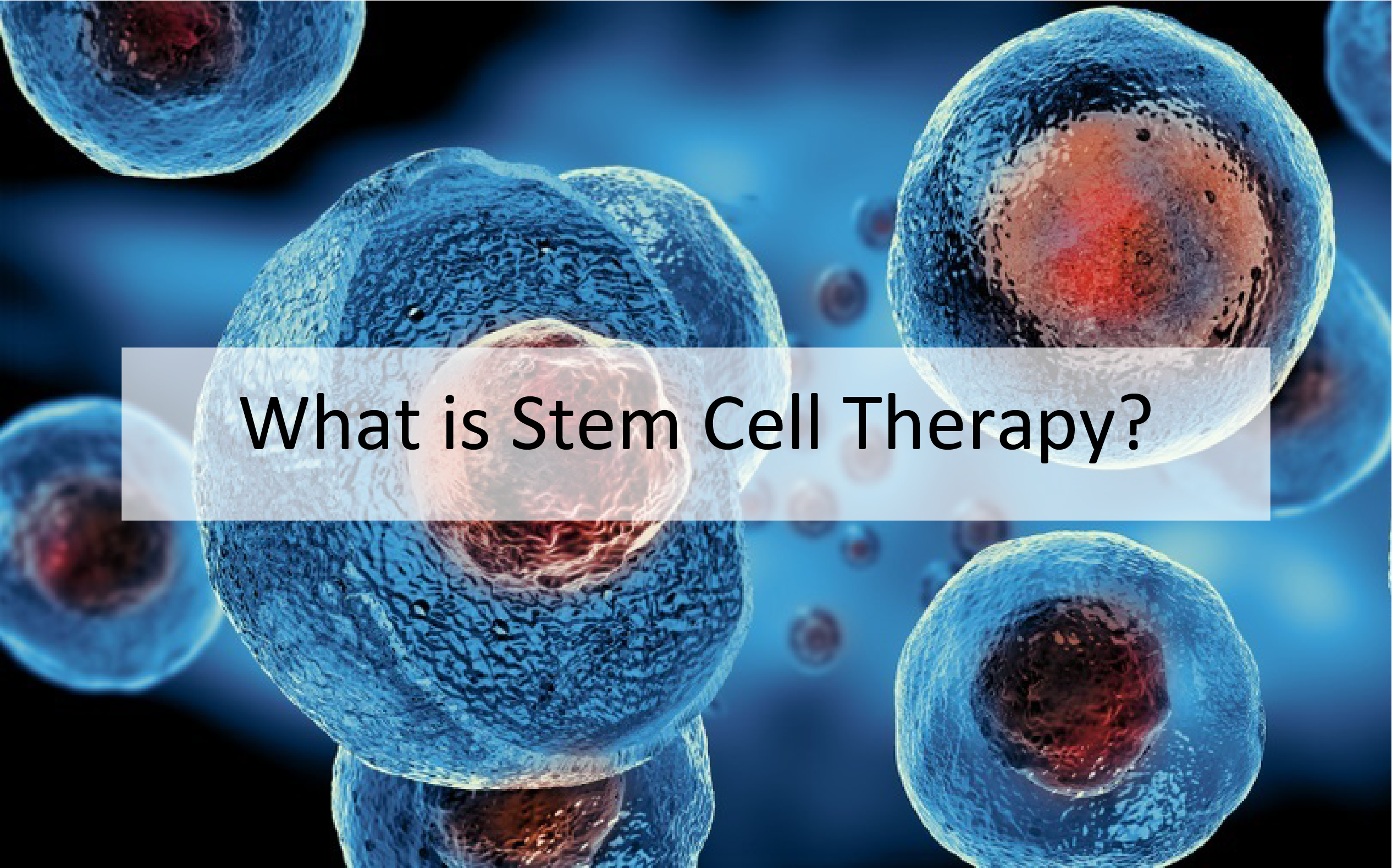 What is Stem Cell Therapy? – Arena Naturals